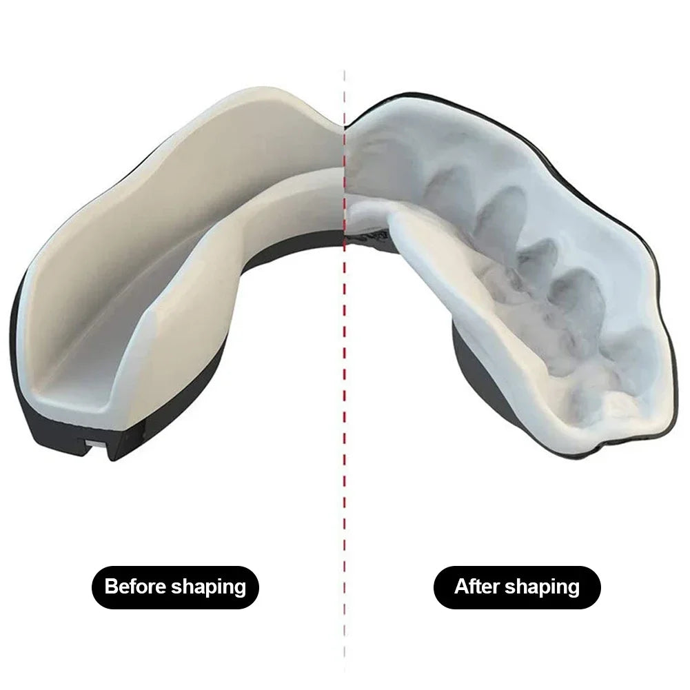 Boxing Mouthguard